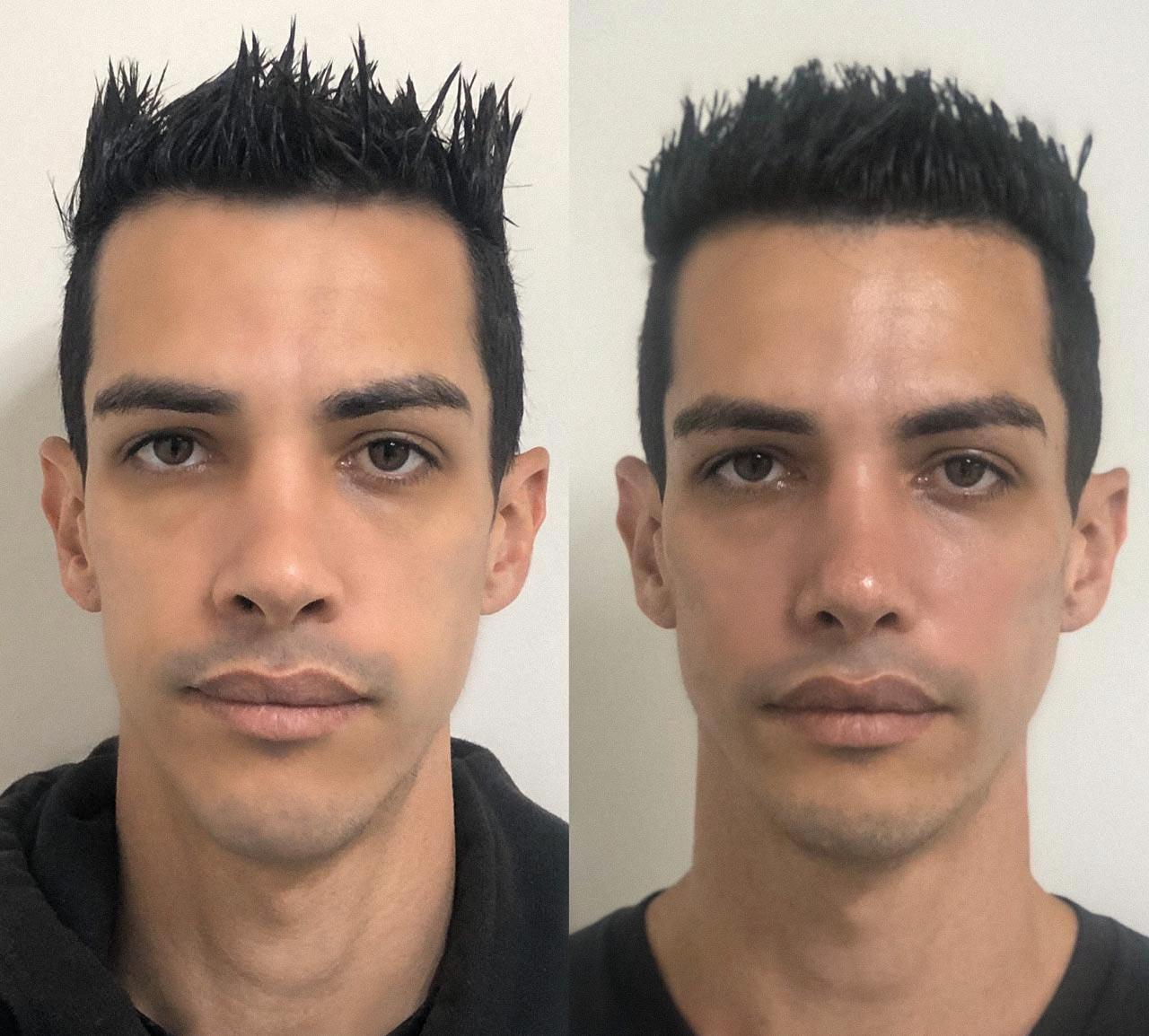 https://mairaplatero.com.br/wp-content/uploads/2021/10/harmonizacao-facial-masculina-como-funciona.jpg