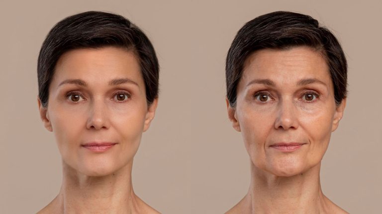 Envelhecimento Facial: Saiba o que é, e como acontece